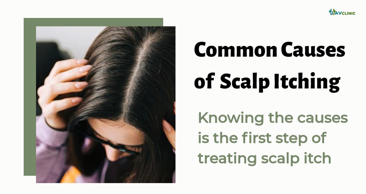 Scalp Itching Effective Treatment 24/01/2023